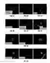 Fig. 07 - ANTI-MCAM ANTIBODIES AND ASSOCIATED METHODS OF USE