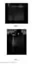Fig. 02 - Personal care products comprising microfibrous cellulose and methods of making the same