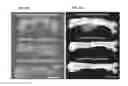 Fig. 08 - METHODS FOR ACCELERATING BONE REPAIR