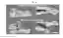 Fig. 09 - METHODS FOR ACCELERATING BONE REPAIR