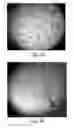 Fig. 45 - METHODS AND COMPOSITIONS FOR CELL-PROLIFERATION-RELATED DISORDERS