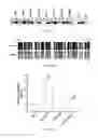 Fig. 15 - Methods for amplifying DNA from the promoter of the NDRG4 gene DNA obtained from a fecal sample