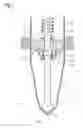 Fig. 02 - Injection valve