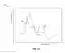 Fig. 08 - Dropout detection in continuous analyte monitoring data during data excursions