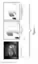 Fig. 06 - Magnetic resonance imaging with consistent geometries