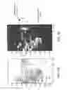 Fig. 06 - Wafer scale sensor ultra-wideband array for tissue diagnosis