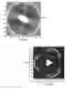 Fig. 08 - Wafer scale sensor ultra-wideband array for tissue diagnosis