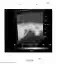 Fig. 04 - THREE/FOUR DIMENSIONAL IMAGING FOR BIG OILFIELD DATA