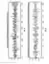 Fig. 04 - Method for locating seismic diffractors in subsurface formations from a wellbore
