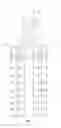 Fig. 02 - Adjustable sensor streamer stretch section for noise control for geophysical sensor streamers
