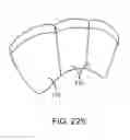 Fig. 147 - LENS ARRAY OPERATIVELY COUPLED TO A SPATIAL LIGHT MODULATOR FOR AUGMENTED OR VIRTUAL REALITY