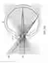 Fig. 44 - LENS ARRAY OPERATIVELY COUPLED TO A SPATIAL LIGHT MODULATOR FOR AUGMENTED OR VIRTUAL REALITY