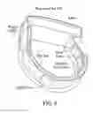 Fig. 12 - Methods and apparatus for recognition of a plurality of gestures using roll pitch yaw data