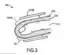 Fig. 05 - ELECTRICALLY CONDUCTIVE BANDAGE FOR USE WITH TOUCHSCREEN DEVICES