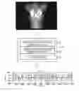 Fig. 01 - System and method for generating pseudo electrogram