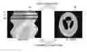 Fig. 01 - Tomography apparatus and method for reconstructing tomography image thereof