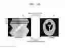 Fig. 03 - Tomography apparatus and method for reconstructing tomography image thereof