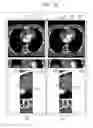 Fig. 42 - Tomography apparatus and method for reconstructing tomography image thereof