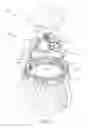 Fig. 03 - WEARABLE ARTICLE WITH SELF-DEFENSE ALARM