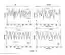 Fig. 04 - Method and system of rapid screening for mild traumatic brain injury (MTBI) and other cognitive impairment by analysis of intra-individual variability of motor performance