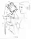 Fig. 07 - Method and system of rapid screening for mild traumatic brain injury (MTBI) and other cognitive impairment by analysis of intra-individual variability of motor performance