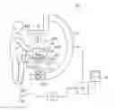 Fig. 01 - Doctor aware automatic collimation