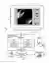 Fig. 02 - Visualization guided ACL localization system