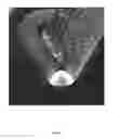 Fig. 09 - SCAFFOLD WITH CORTICAL WALL