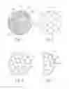 Fig. 02 - Hybrid breast implant, method for making and using same