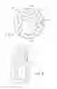 Fig. 04 - Hybrid breast implant, method for making and using same