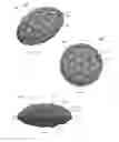 Fig. 22 - Hybrid breast implant, method for making and using same
