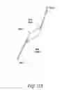 Fig. 05 - Intraocular lens
