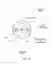 Fig. 07 - Intraocular lens