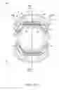 Fig. 08 - Intraocular lens