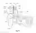 Fig. 08 - IMPLANTABLE ACTUATOR FOR HEARING AID APPLICATION