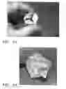 Fig. 08 - Extracellular matrix material valve conduit and methods of making thereof