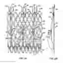 Fig. 02 - Everting Heart Valve
