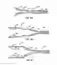 Fig. 06 - Everting Heart Valve