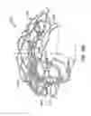 Fig. 46 - Everting Heart Valve