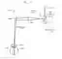 Fig. 22 - LASER ASSISTED CATARACT SURGERY
