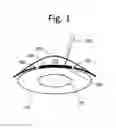 Fig. 02 - Laser assisted cataract surgery