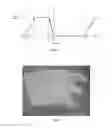 Fig. 02 - Pressure cuff or garment