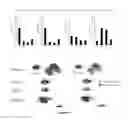 Fig. 14 - Lipid membrane structure including bacterial cell component having dispersibility in non-polar solvent, and method for producing same