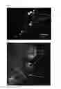 Fig. 02 - Composition comprising cytokine macro-aggregates
