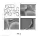 Fig. 20 - CARTRIDGE AND METHOD FOR INCREASING MYOCARDIAL FUNCTION