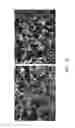 Fig. 25 - CARTRIDGE AND METHOD FOR INCREASING MYOCARDIAL FUNCTION