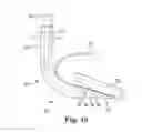 Fig. 09 - Laryngeal mask