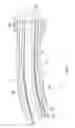 Fig. 09 - Catheter with multi-functional control handle having rotational mechanism