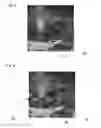 Fig. 07 - MEDICAL SYSTEM AND METHOD FOR PLANNING AND/OR TUNING A NEUROMODULATION THERAPY
