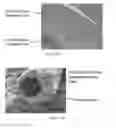 Fig. 05 - Hollow fiber membrane having hexagonal voids
